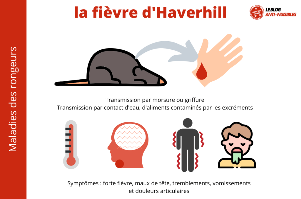 Fièvre d'Haverhill - rat bite fever
